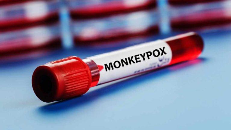 monkeypox-thefreemedia